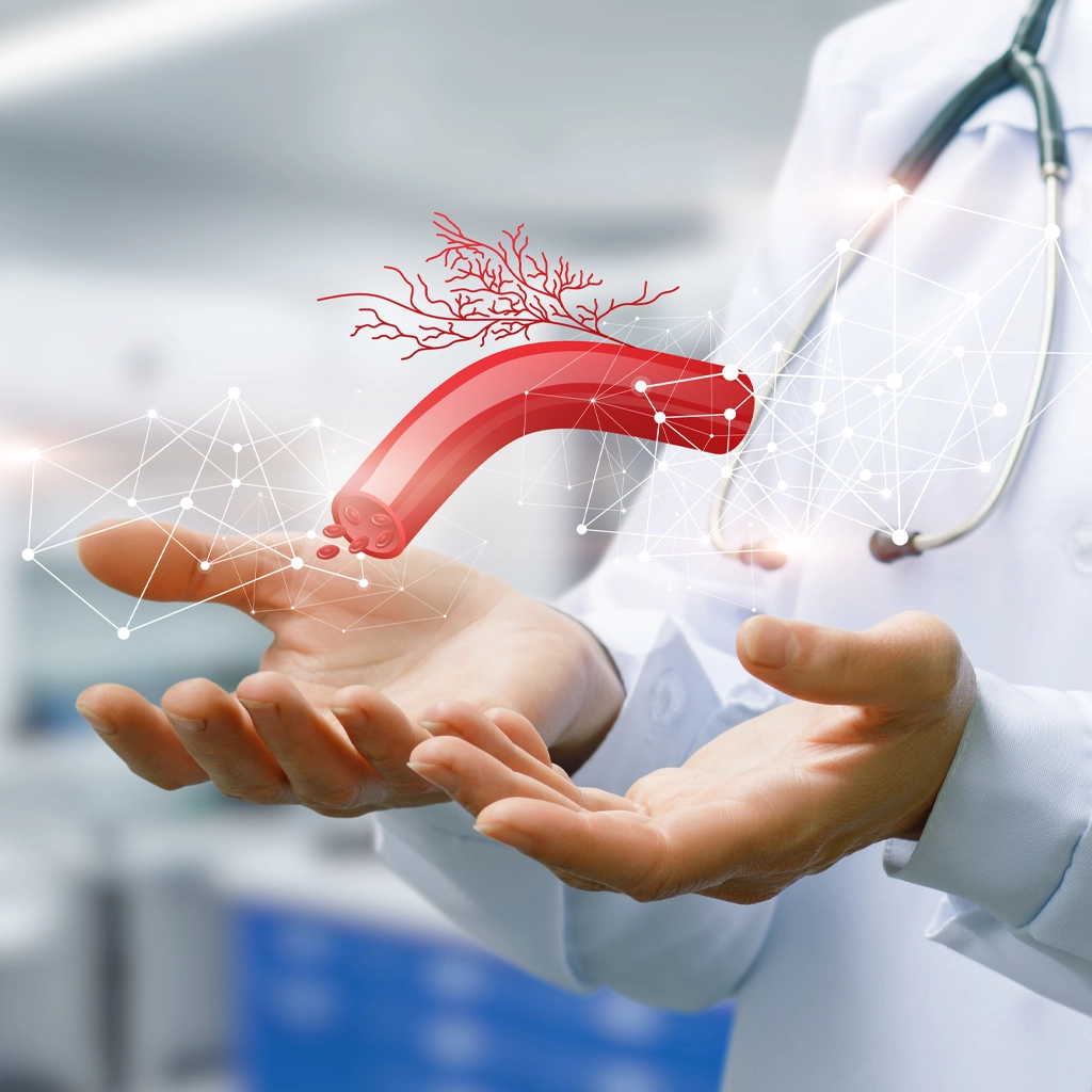 Venous Disease Treatment