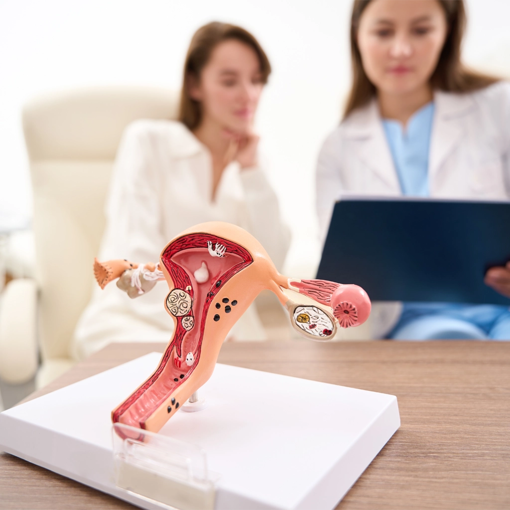 uterine fibroids